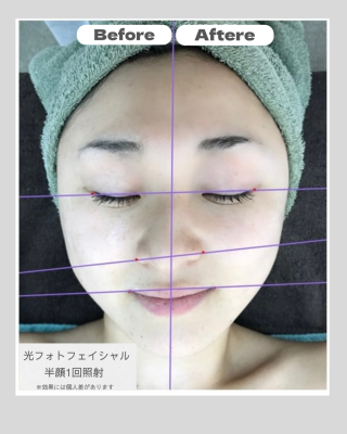 Before.png